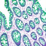 Immunohistochemistry: Origins, Tips, and a Look to the Future